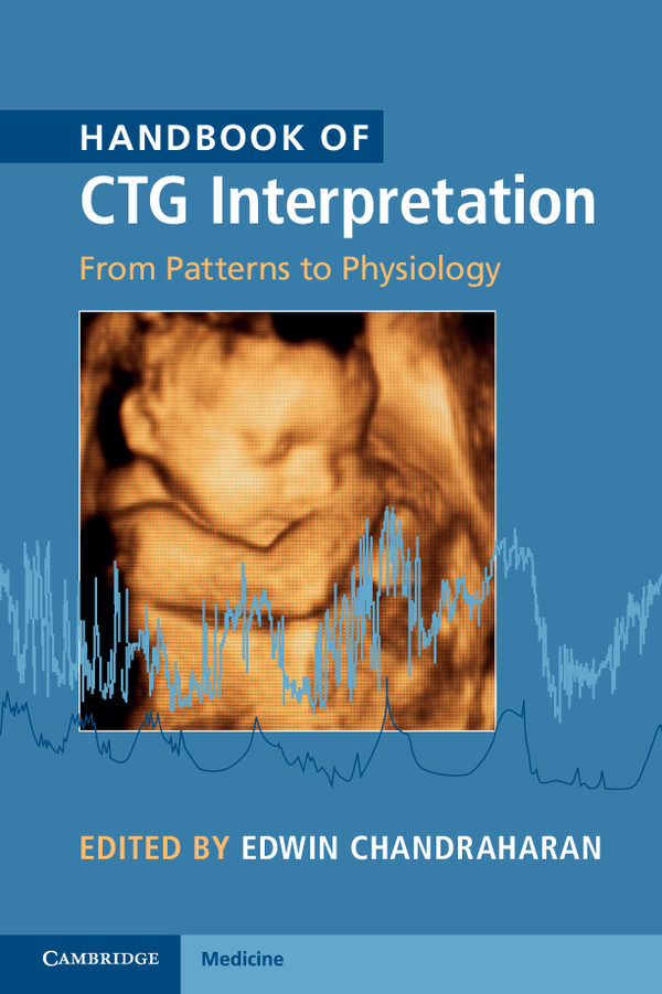 Handbook of CTG Interpretation:From Patterns to Physiology ebook